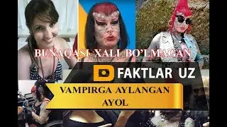 Vampirga aylangan ayol. Butun dunyo hayratda