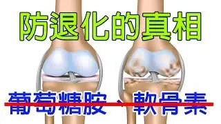 Glucosamine are not statistically significant to Knee degeneration!!