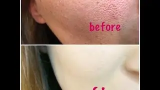 HOW TO HIDE PORES !!