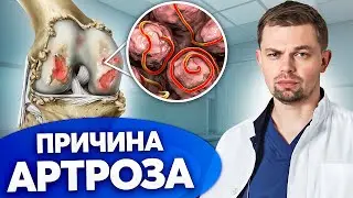 Скрытые причины боли! Как ПАРАЗИТЫ влияют на суставы?