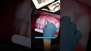 Как Вам результат?😍 