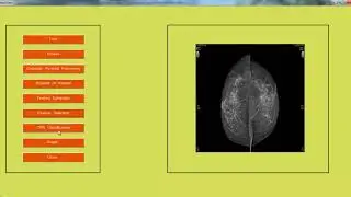 Digital Image Processing Projects List | Digital Image Processing Thesis List