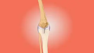 Knee  Anatomy pain Animated Surgical video for medical interns