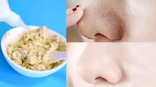 Sebum Plugs Clean Up Instantly - Clean Pores At Home