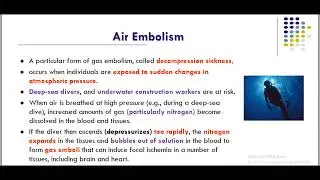 Air Embolism