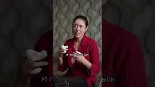 Развиваются гангрены и трофические язвы: как живет Наталья #shortsviral #subscribe #помощь #shorts
