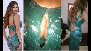 Top 10 Most Embarrassing Celebrity Moments 2017