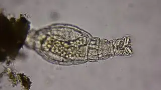Rotifer under a microscope