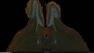 Whole Mouse Brain