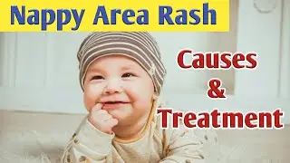 Nappy Area Rash Causes, Symptoms, Diagnosis & Treatment