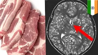 Remaja meninggal setelah makan babi tidak matang - TomoNews