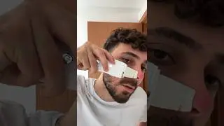 Fiz Hematoma no nariz tentando tirar os cravos