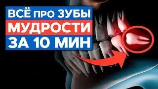 When should wisdom teeth be removed? / Indications and consequences of tooth extraction