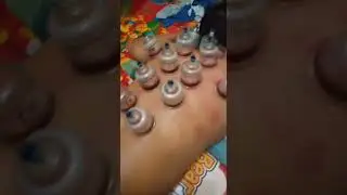 Terapi Pijat, Urut, Kerokan, Totok Syaraf & Bekam