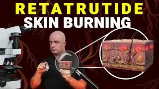 Next Ozempic? Retatrutide's Unknown Skin Effect (Pathologist Explains)