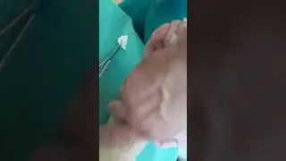 Будни хирурга или про бабушку,которая разбирается в триггерных точках.