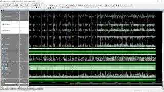 Implementation of High-Precision MFCC Feature Extraction Using FPGA for Speech Recognition