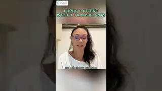 Story Of Lupus Patient With 2 Kidney Transplants | #Transplant #Lupus