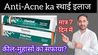 How to Use Clarina Anti Acne Cream | कील-मुंहासों का स्थायी इलाज सही तरीके से |