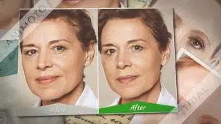 how to get rid of wrinkles under eyes