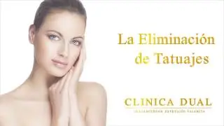 ELIMINACIÓN DE TATUAJES - Antes y Después