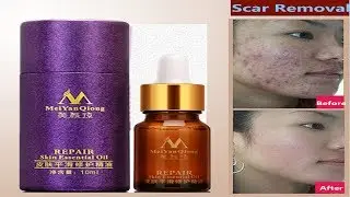 Oil Lavender For Scar Repair & Skin Care Compound Essential Oil Essential Oil