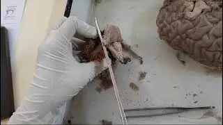 Brain stem - external features