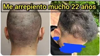 ¡No fue en Turquía! 😡 Me fastidian la VIDA en España INSPARYA 😤 AUDIOS 🚏📞