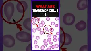 What are tear drop cells ? 🤔😲