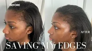 I Grew My Edges Back...Again | The Product That Saved Me Hair | Niara Alexis