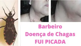 Barbeiro !!! Doença de Chagas