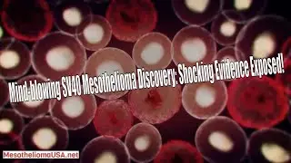 Simian Virus 40 Mesothelioma - Conflicting Evidence About SV40