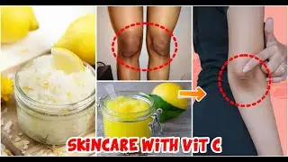 Best Hand & Feet Whitening Home Remedy | Fast Way To Get White Hand & Feet