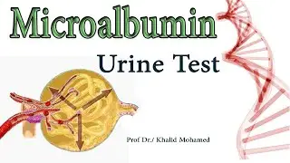 ميكروألبومين (MA، ألبومين البول، نسبة الألبومين إلى الكرياتينين)