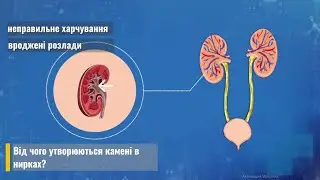 Від чого утворюються камені у нирках