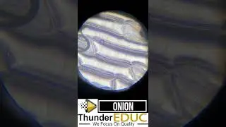 The plant cell under a microscope onion cells under a microscope thundereduc by m.saidi