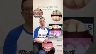 Have you ever felt judged at the dentist’s chair?😬  #dentist #teeth #edmonton #alberta #yeg