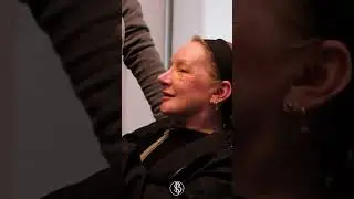 Our patient sees her new nose for the first time after nose surgery. #shorts