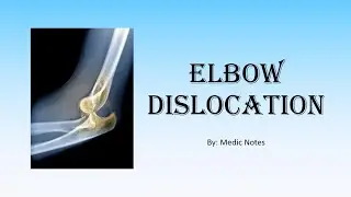 [Ortho] Elbow dislocation - clinical features, investigation, treatment, complications