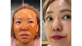 피부관리법