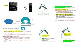 Access complications and management