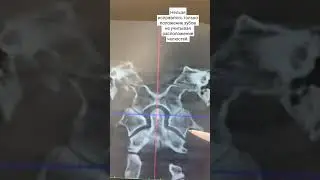 Нельзя исправлять только положение зубов не учитывая расположение челюстей. 
