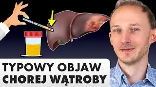 Objawy chorej wątroby, których lepiej nie ignorować