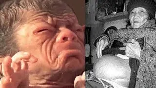 Оламшумул Янгилик! 92 яшар кампир, 40 ёшли болани тугди!