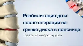 РЕАБИЛИТАЦИЯ ДО И ПОСЛЕ ОПЕРАЦИИ НА ГРЫЖЕ ДИСКА В ПОЯСНИЦЕ. Советы от нейрохирурга