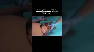 Как проходит кесарево