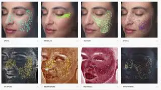 VISIA Skin Analysis 101 | Weiler Plastic Surgery Group