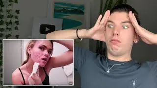Specialist Reacts to Summer McKeen's Skin Care Routine