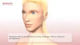 Facelift Animatie - Boerhaave Medisch Centrum