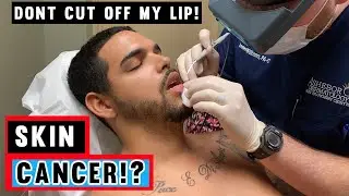 DO I HAVE SKIN CANCER!? HOW TO CHECK FOR SKIN CANCER AND WHEN TO GO TO THE DERMATOLOGIST